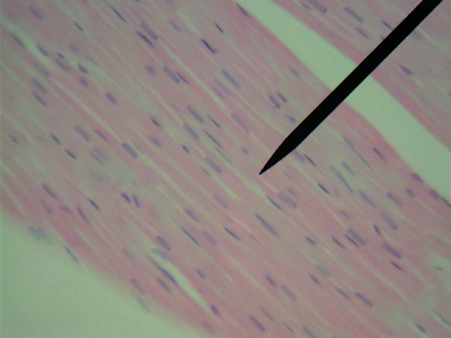  Micrograph of Muscle cells