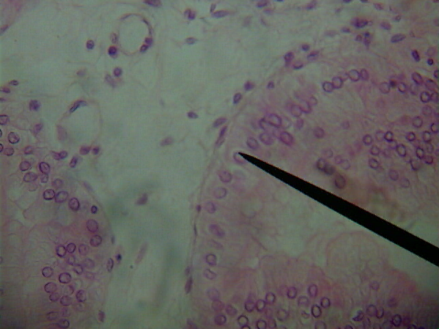  Micrograph of skin cells