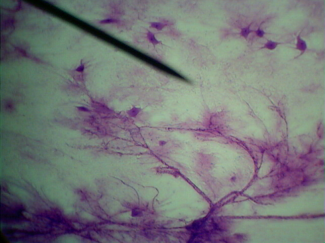 Microghraph of nerve cells