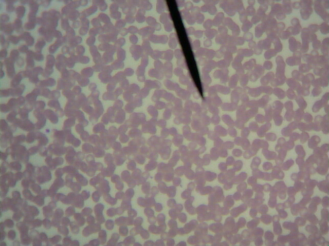 A micrograph of red blood cells